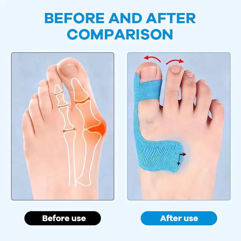 🔥LAST DAY 50% OFF - 👣Pre-cut Hallux Valgus Corrector Kinesiology Tape