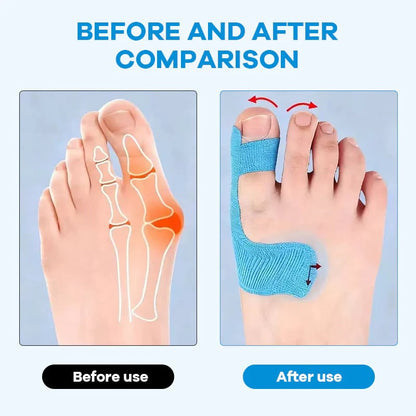 🔥LAST DAY 50% OFF - 👣Pre-cut Hallux Valgus Corrector Kinesiology Tape