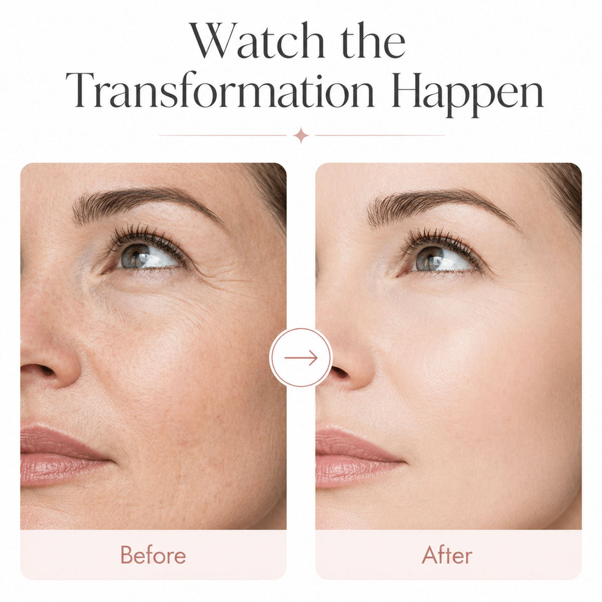 Leouyu™ Time Reverse Cream (All-In-One)