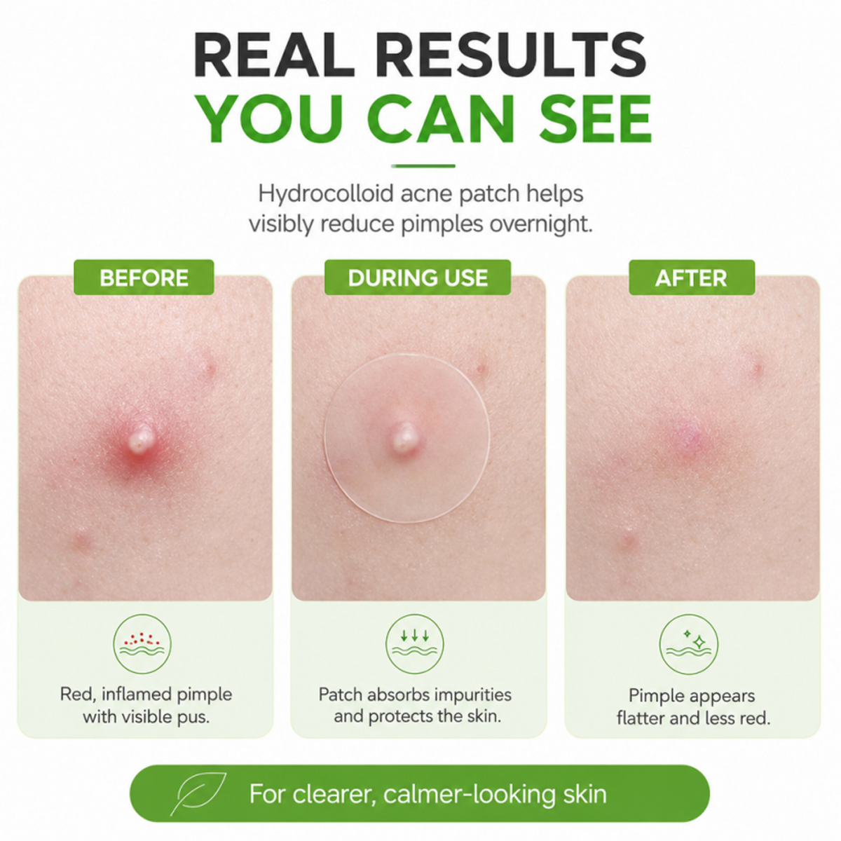 Zero Fit Blemish & Dark Spot Patch Duo
