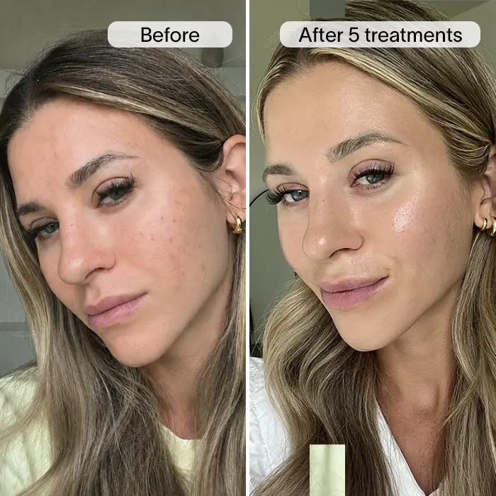 3d48347d7c4be03f96.png
