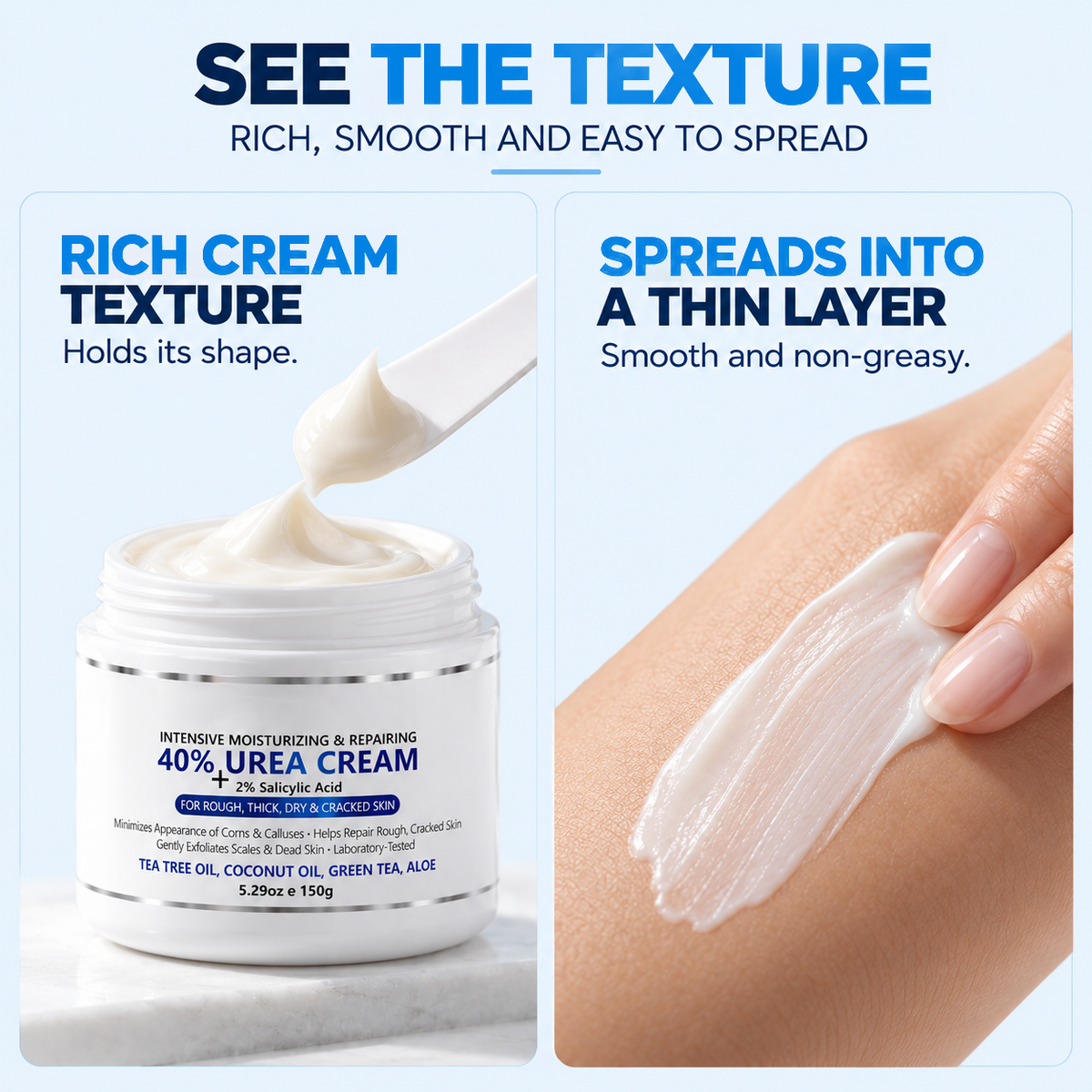 Advanced Keratolytic Cream For Rough, Raised Seborrheic Keratoses