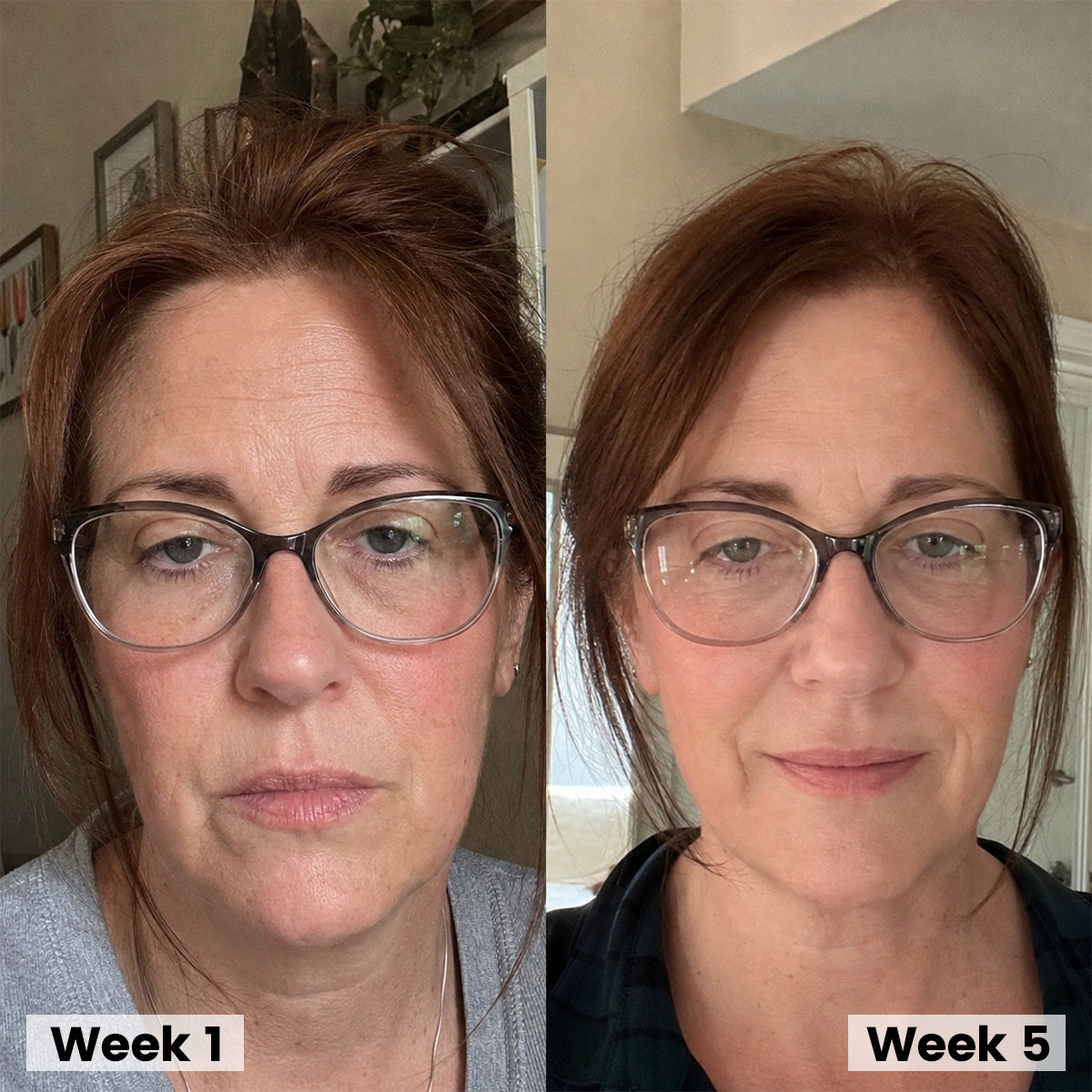 Korean Collagen Serum for Mature Skin