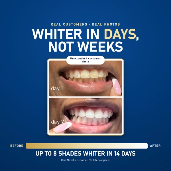Whitening pen product view 2