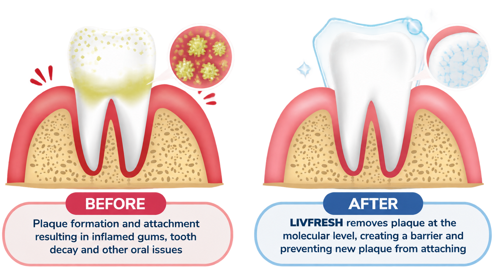 How the molecular clean works